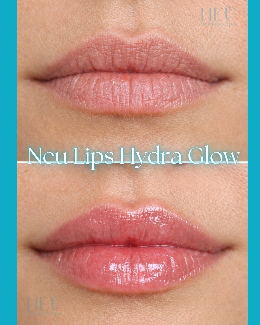 Lip Hydra Glow
